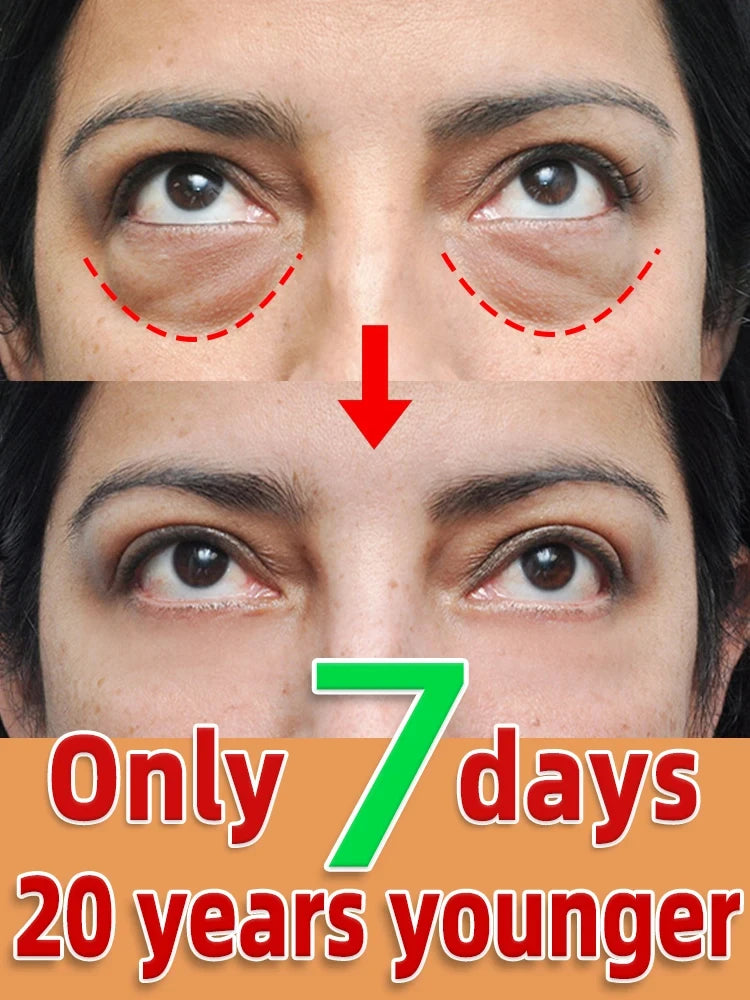 Eye Bags Cream Removal Eyes Wrinkle