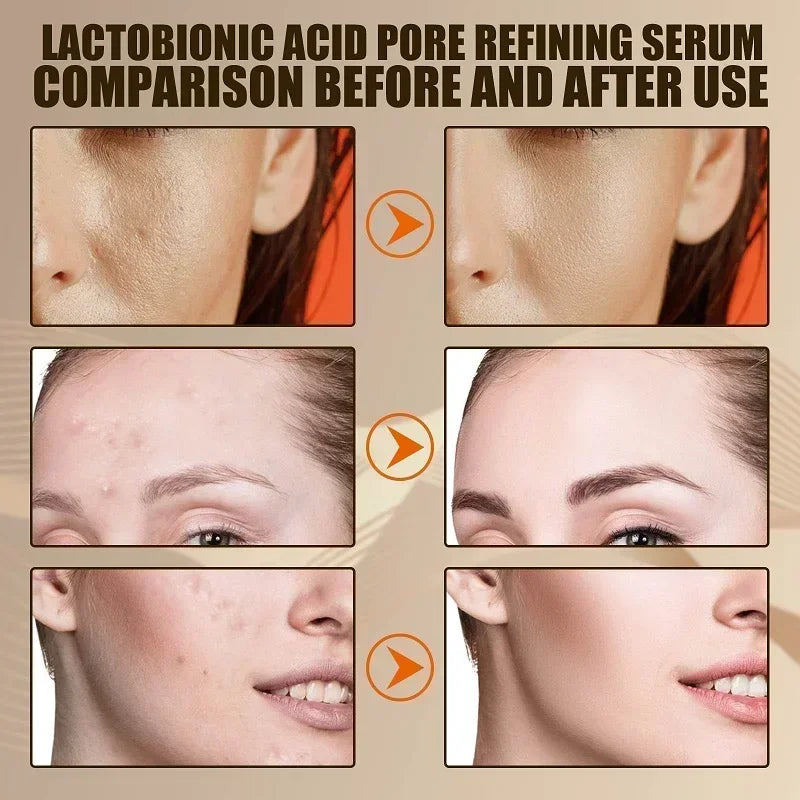 Lactobionic Acid Shrink Pores Facial Serum