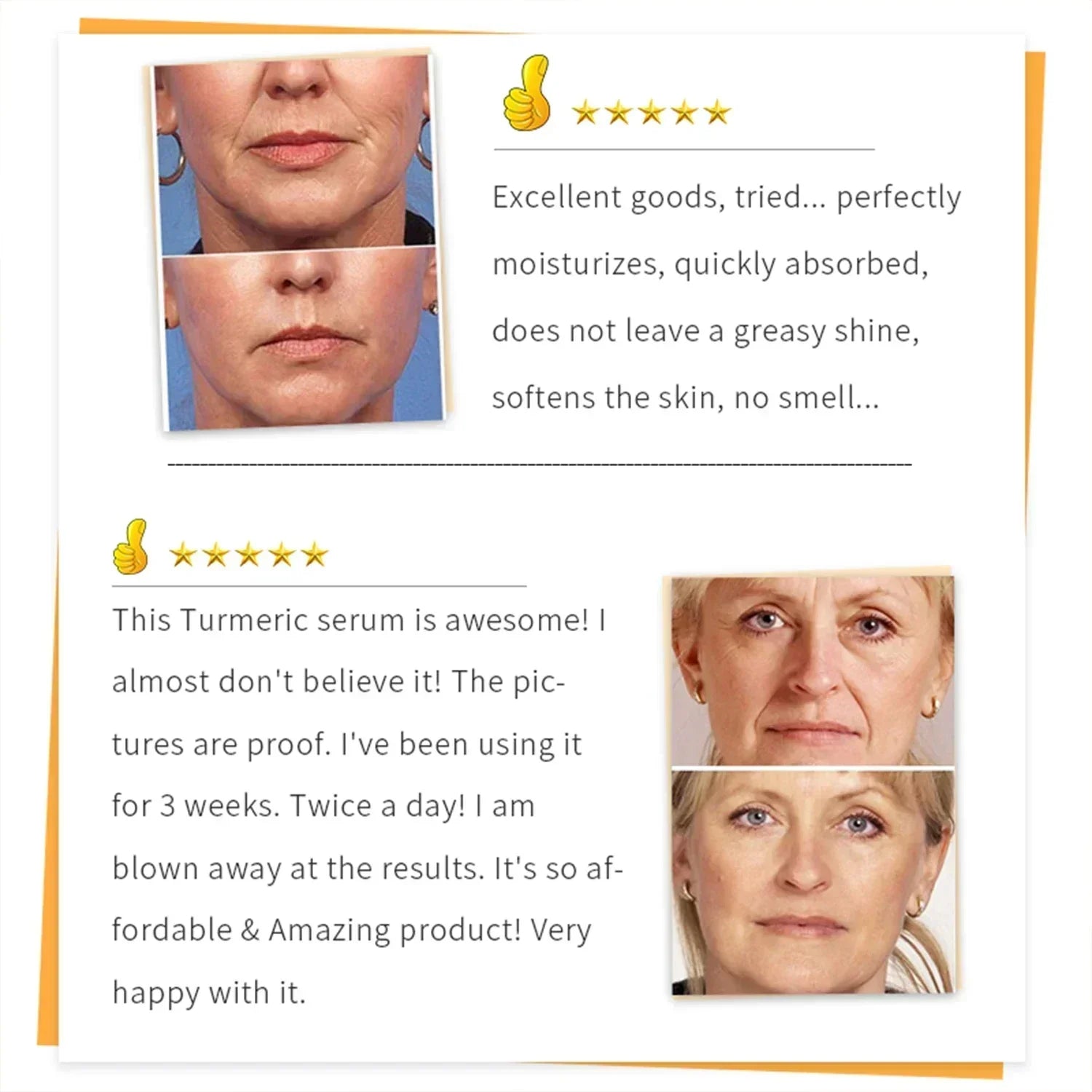 Turmeric Serum Freckle Whitening Fade Dark Spots Removal