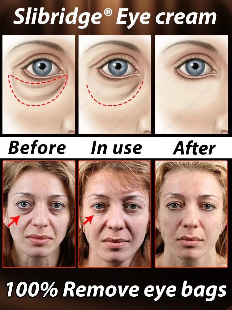 Eye Bags Cream Removal Eyes Wrinkle