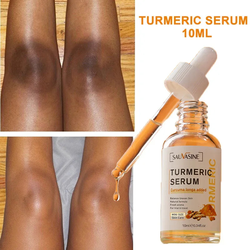 Turmeric Serum Freckle Whitening Fade Dark Spots Removal